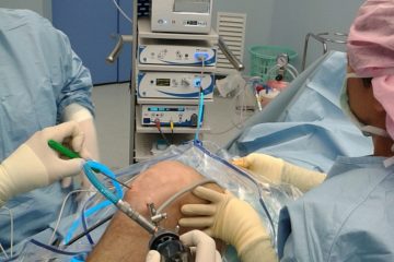 пластика-связки